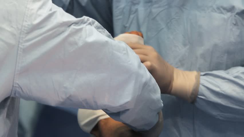 laser tattoo removal with hand stock footage video 22185067 laser tattoo removal with hand stock footage video 22185067